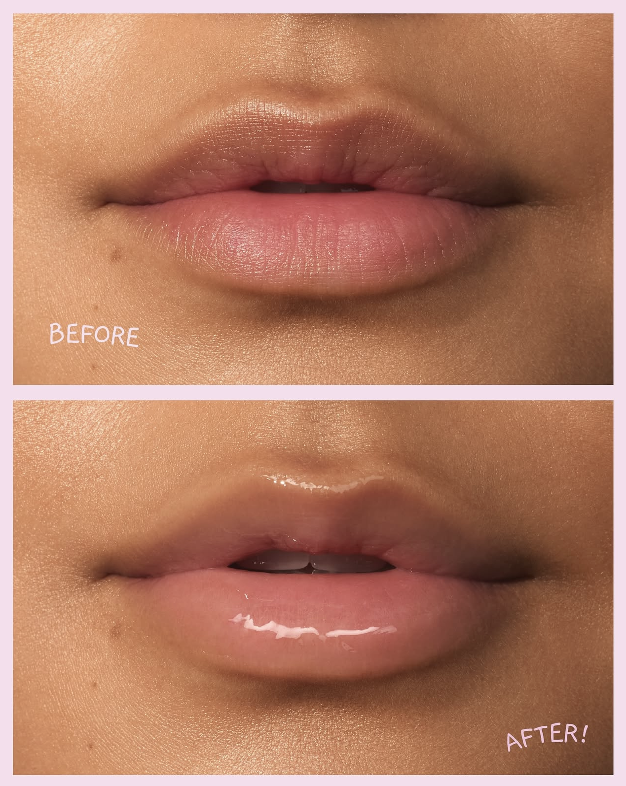 Treat - Lip Treatment